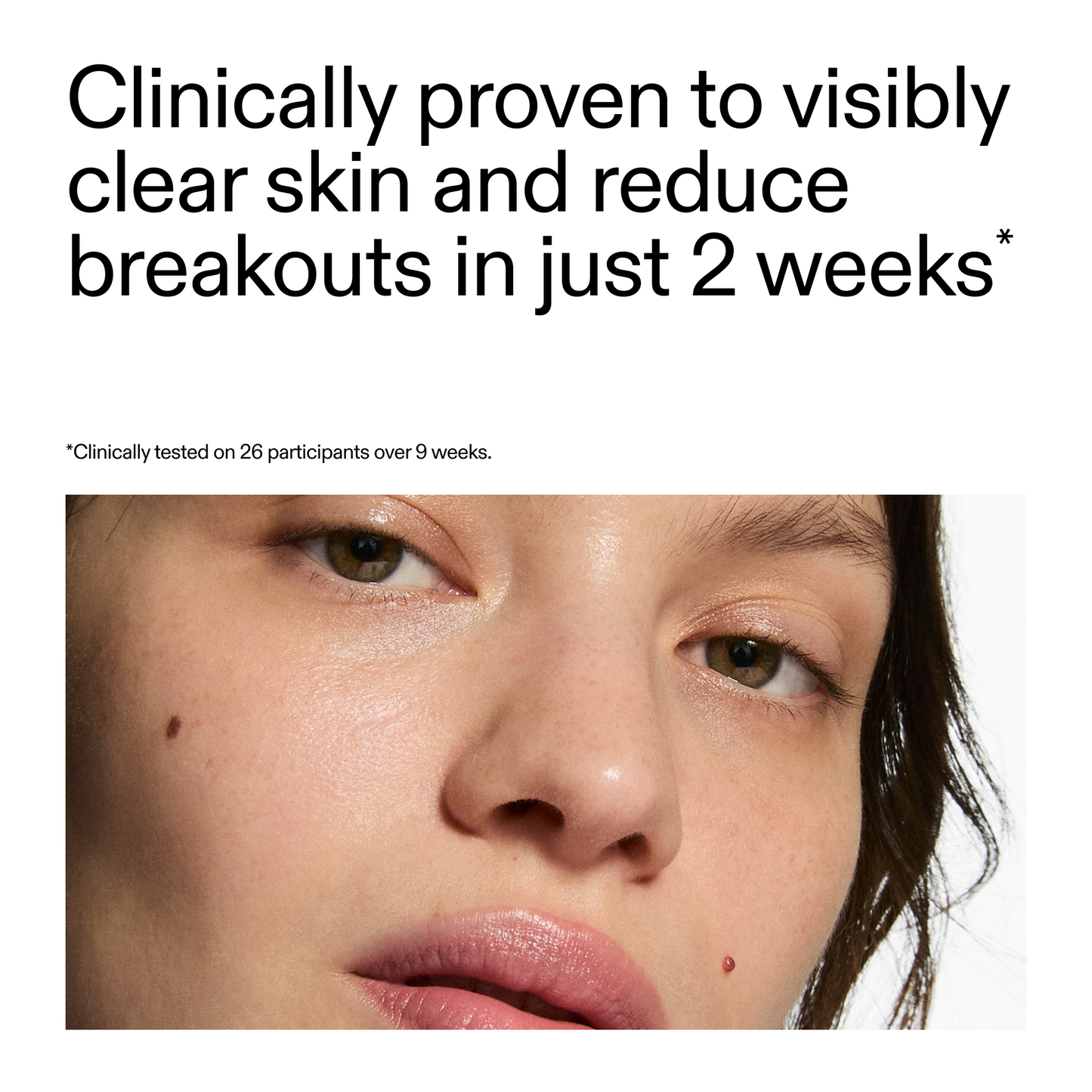 360-acne-clearing-serum-x2 360_Serum_Key_Claim.png