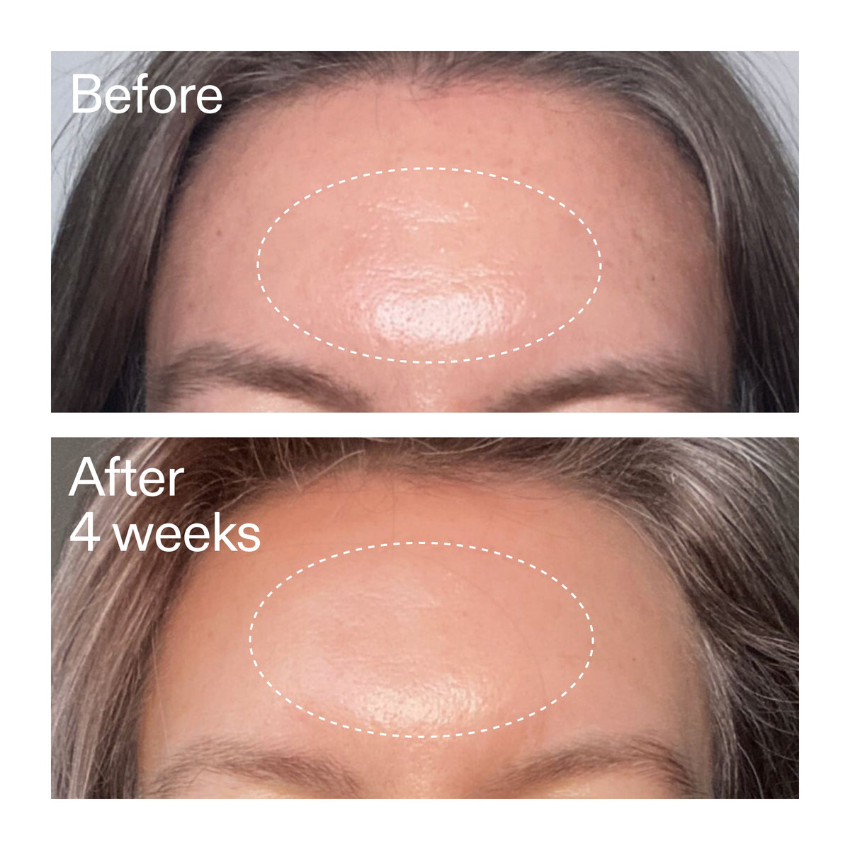 advanced-0-2-retinal-serum-a9 AdvancedRetinal_BeforeAfter1_2000x2000_1da6bb0a-29dd-41d1-95b7-8679696bbf0f.jpg