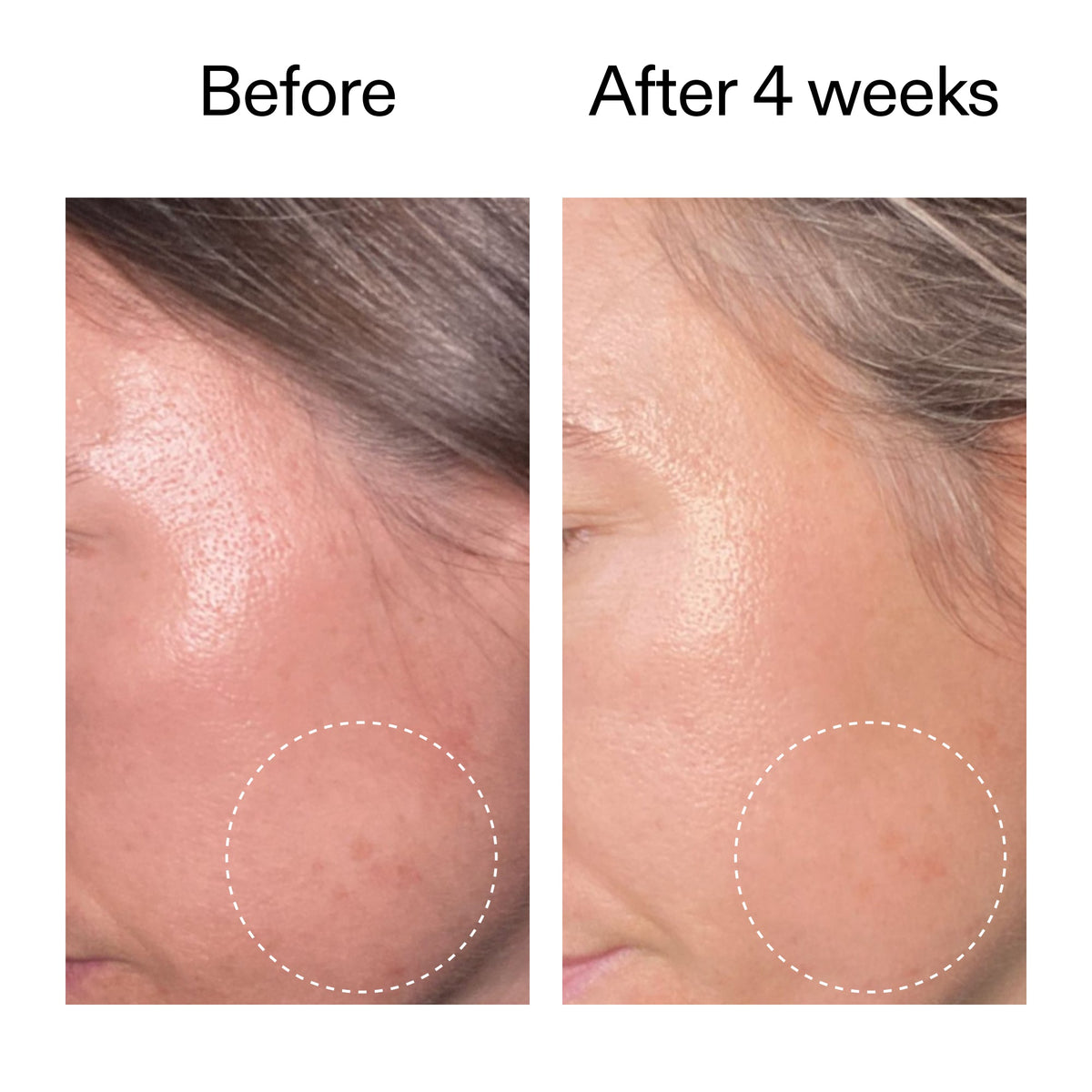 advanced-0-2-retinal-serum-a9 AdvancedRetinal_BeforeAfter2__2000x2000_62fb16bb-77ae-4d63-8500-88dbf847f4b9.jpg
