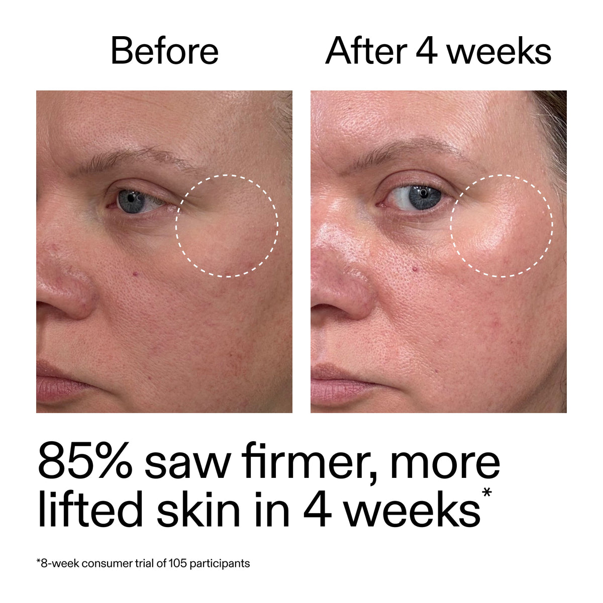 advanced-0-2-retinal-serum-duo-w1 AdvancedRetinal_BeforeAfter_Claim1_2000x2000_3a315aa8-f408-4b33-bbeb-0d9209f98404.jpg
