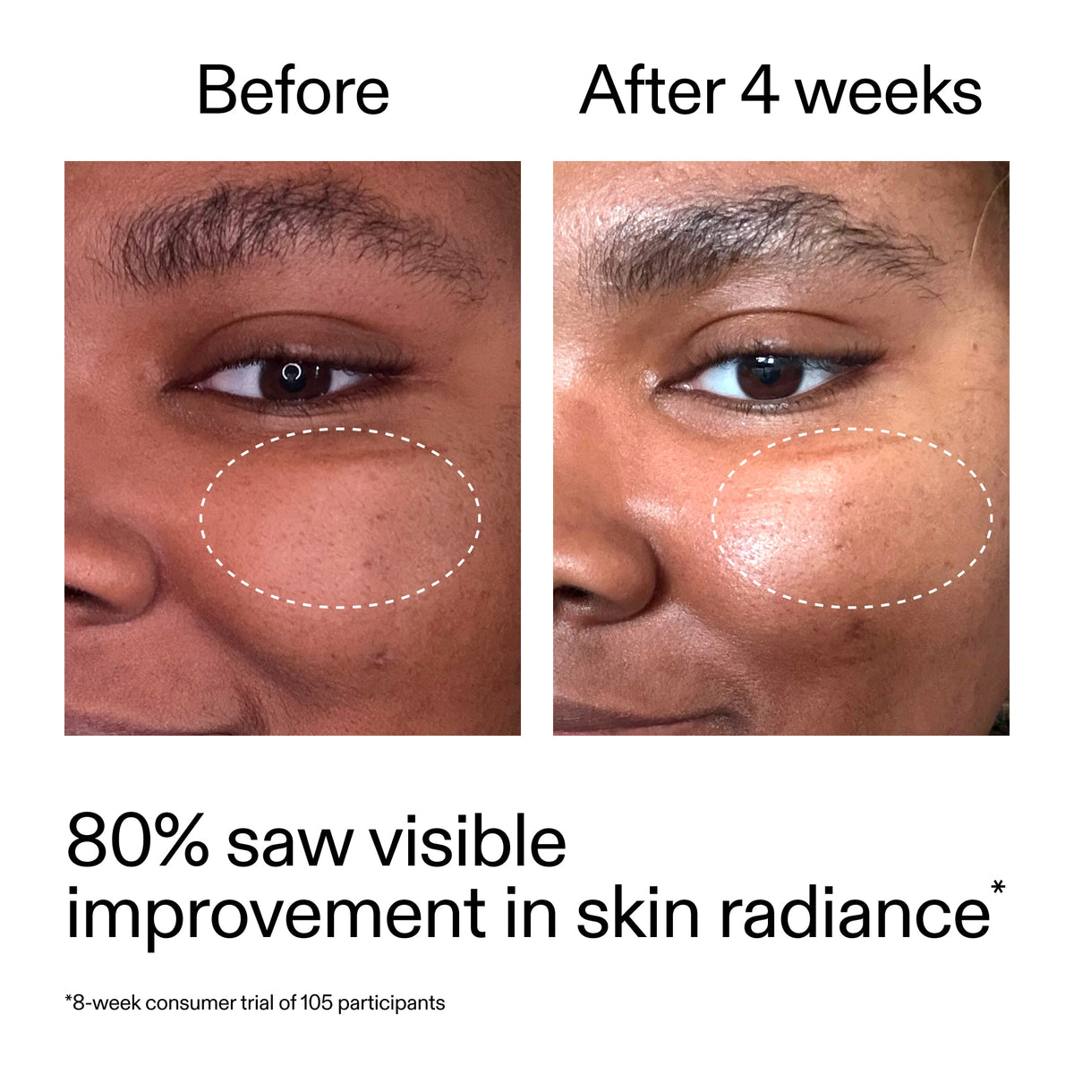 advanced-0-2-retinal-serum-a9 AdvancedRetinal_BeforeAfter_Claim2_2000x2000_39d11e3d-eda9-44ec-ab32-2903b1a368bd.jpg