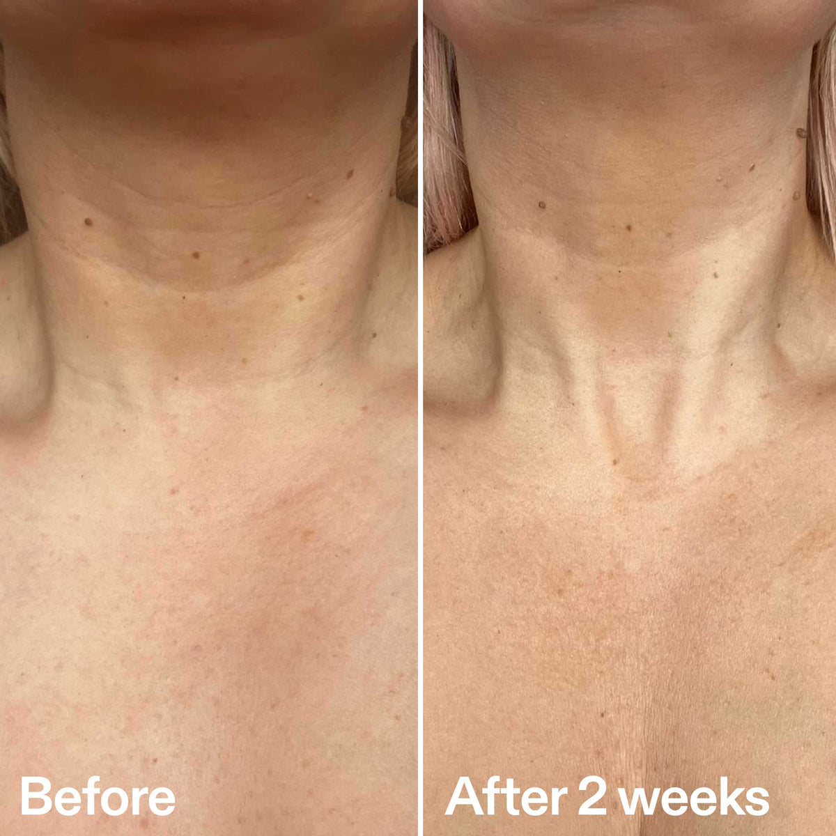 bio-active-neck-lift-stick-r1 B_A_2.jpg