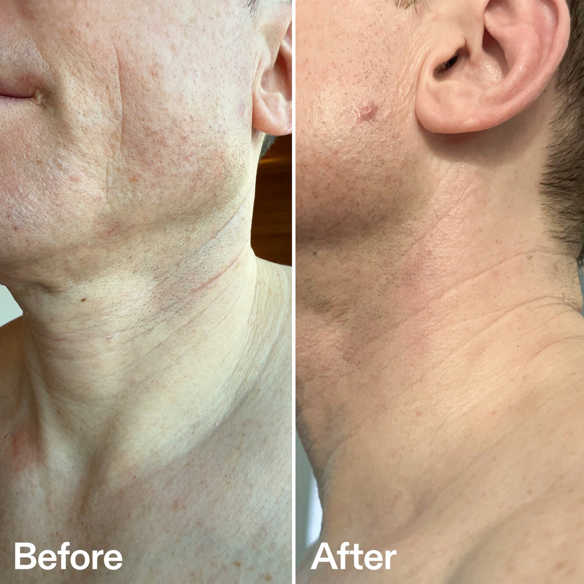 bio-active-neck-lift-stick-r1 B_A_afa2743e-b8e2-4504-92f4-e281cb6cf759.jpg