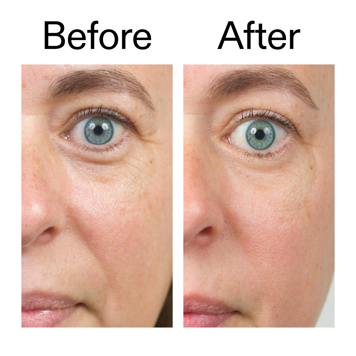 bio-active-ceramide-moisturizer-duo-h6 Bio-Active_Before_After_2000x2000_566e5a9e-135e-417a-8242-b44e5fa35463.jpg