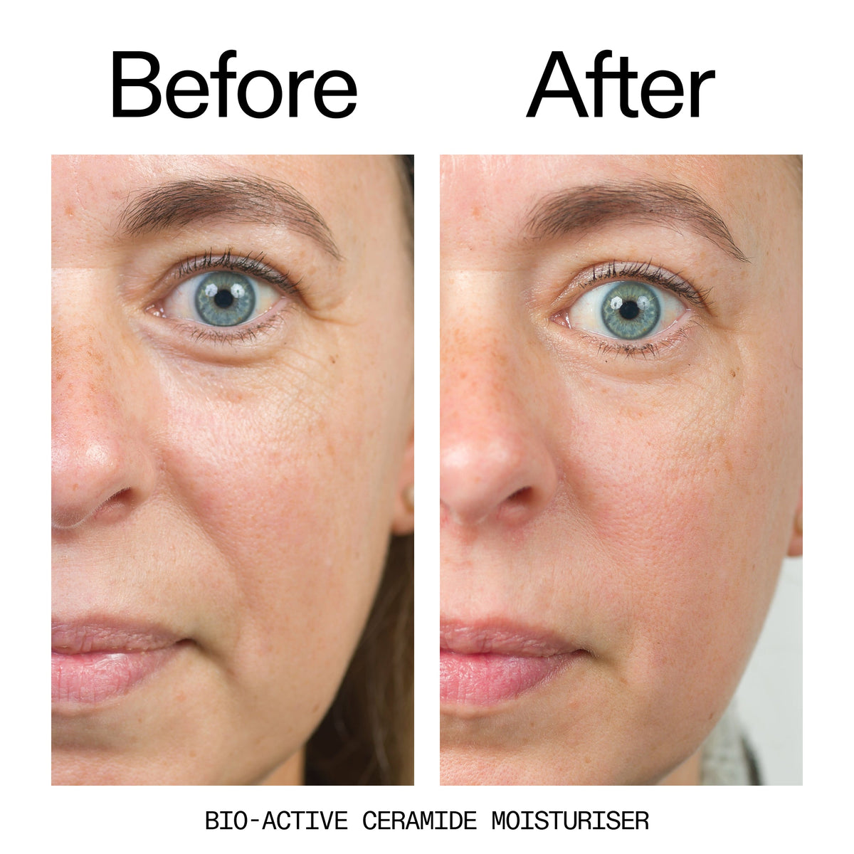 barrier-boosting-trio-i3 Bio-Active_Before_After_2000x2000_600947b4-e8c5-425a-9155-fc15bc83aa12.jpg
