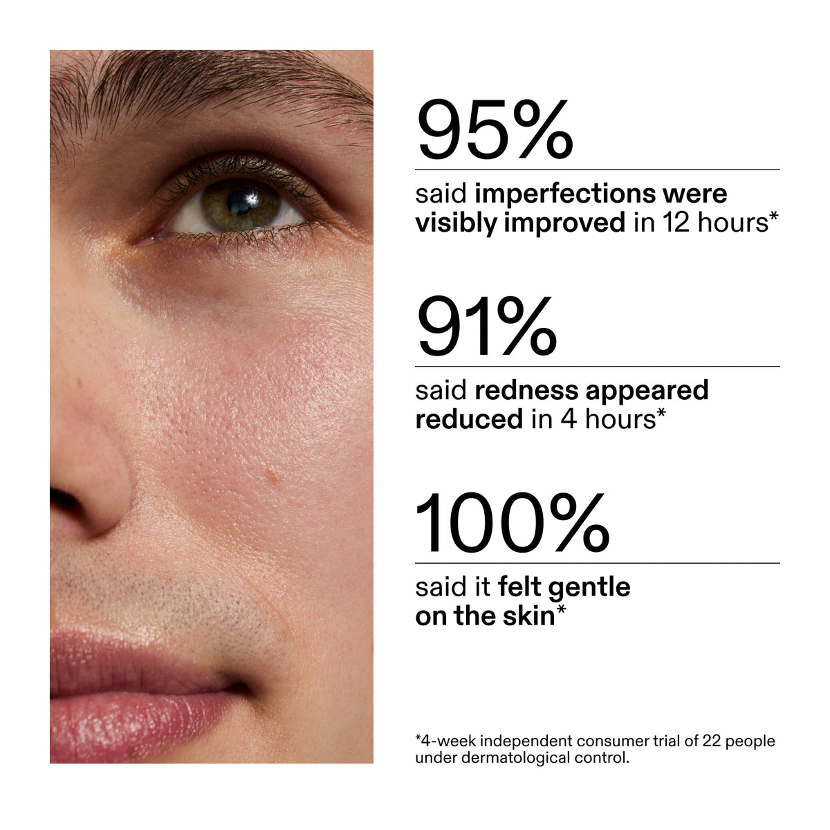 succinic-acid-acne-treatment-b0 CA_Succinic_Acid_Treatment_key_Claims_2000x2000_db91b0f1-7f29-4bfe-bb16-63a47f500960.jpg