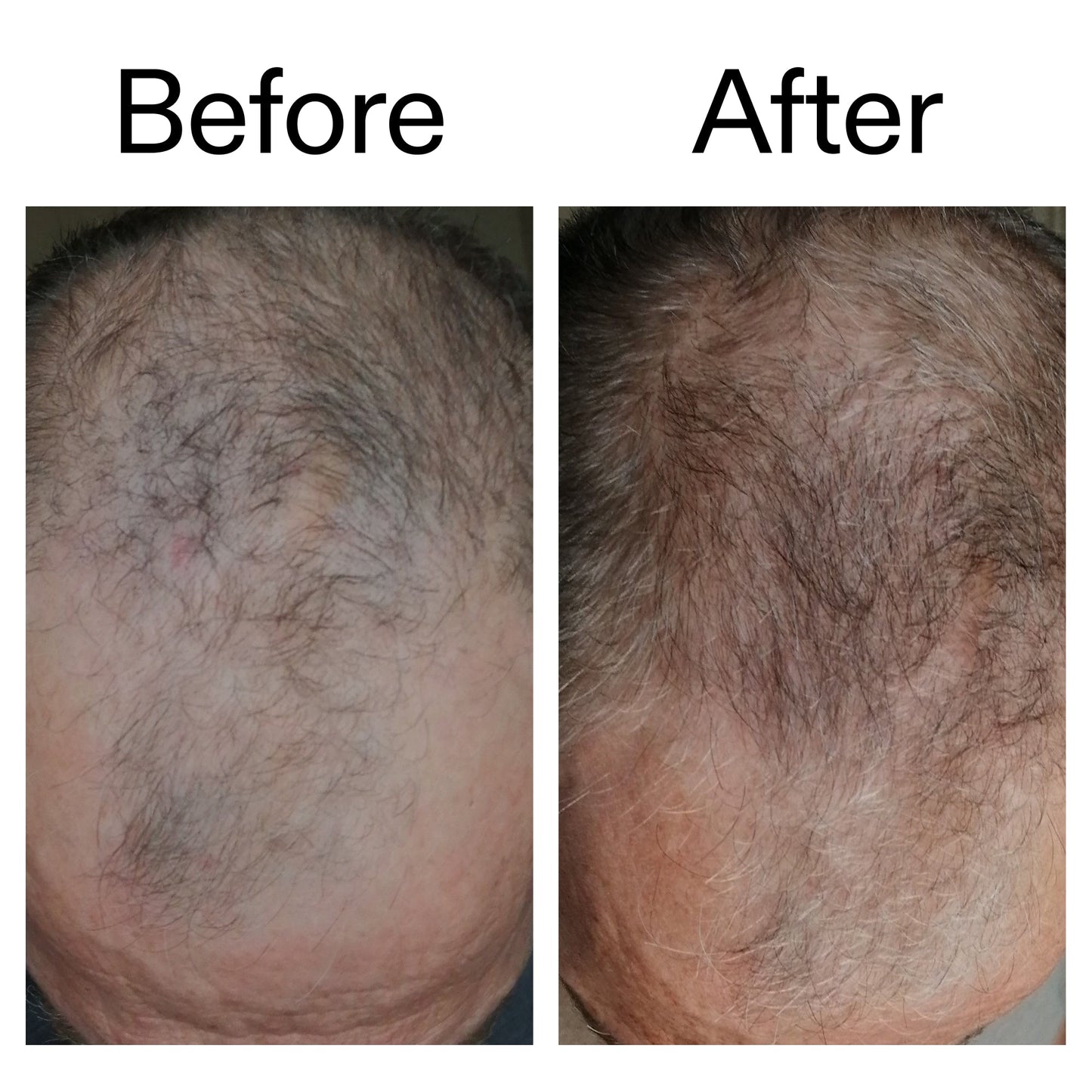 caffeine-stimulating-scalp-treatment-v5 Caffeine_Scalp_Treatment_B_A_Ppage_2000_x_2000.jpg