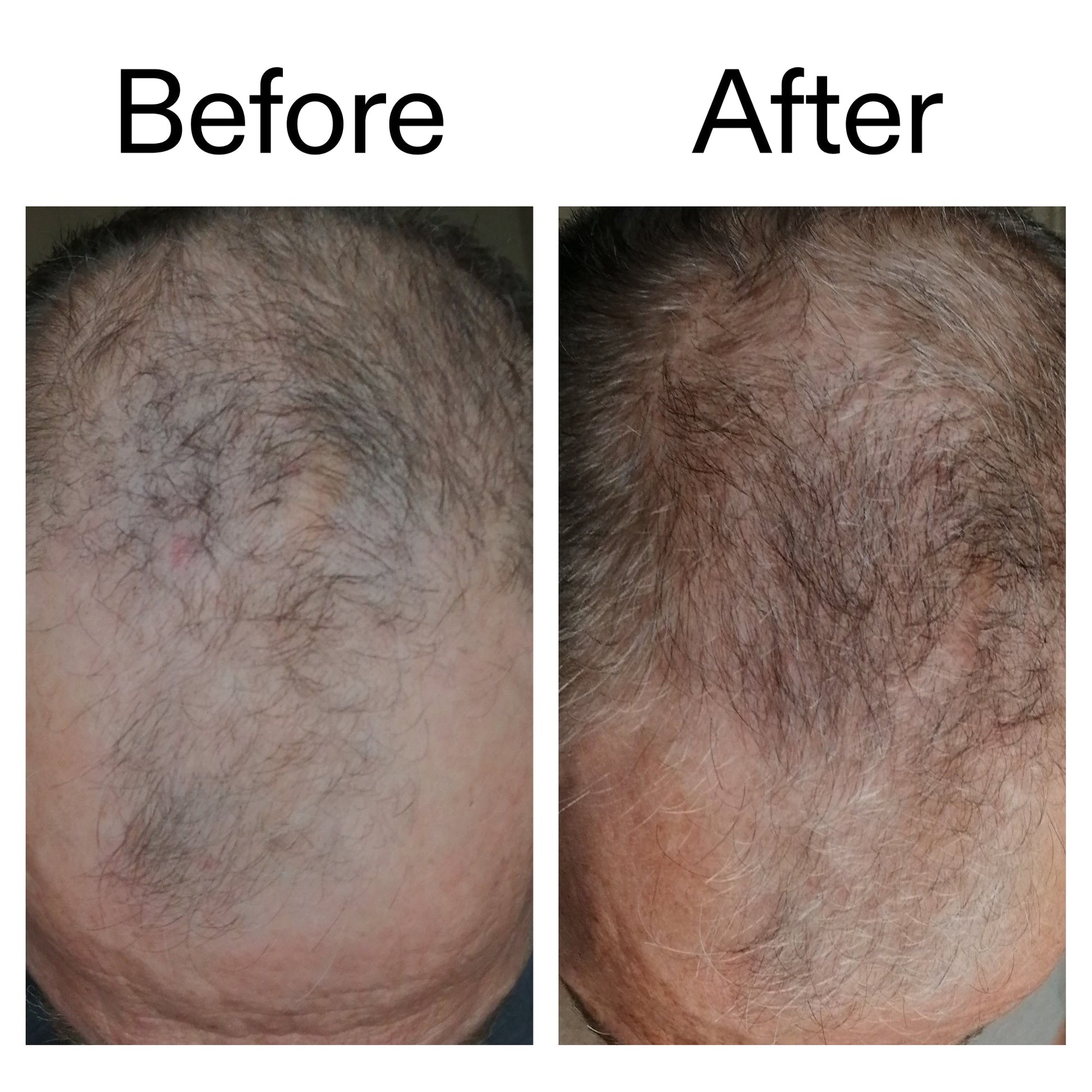 caffeine-stimulating-scalp-treatment-v5 Caffeine_Scalp_Treatment_B_A_Ppage_2000_x_2000.jpg