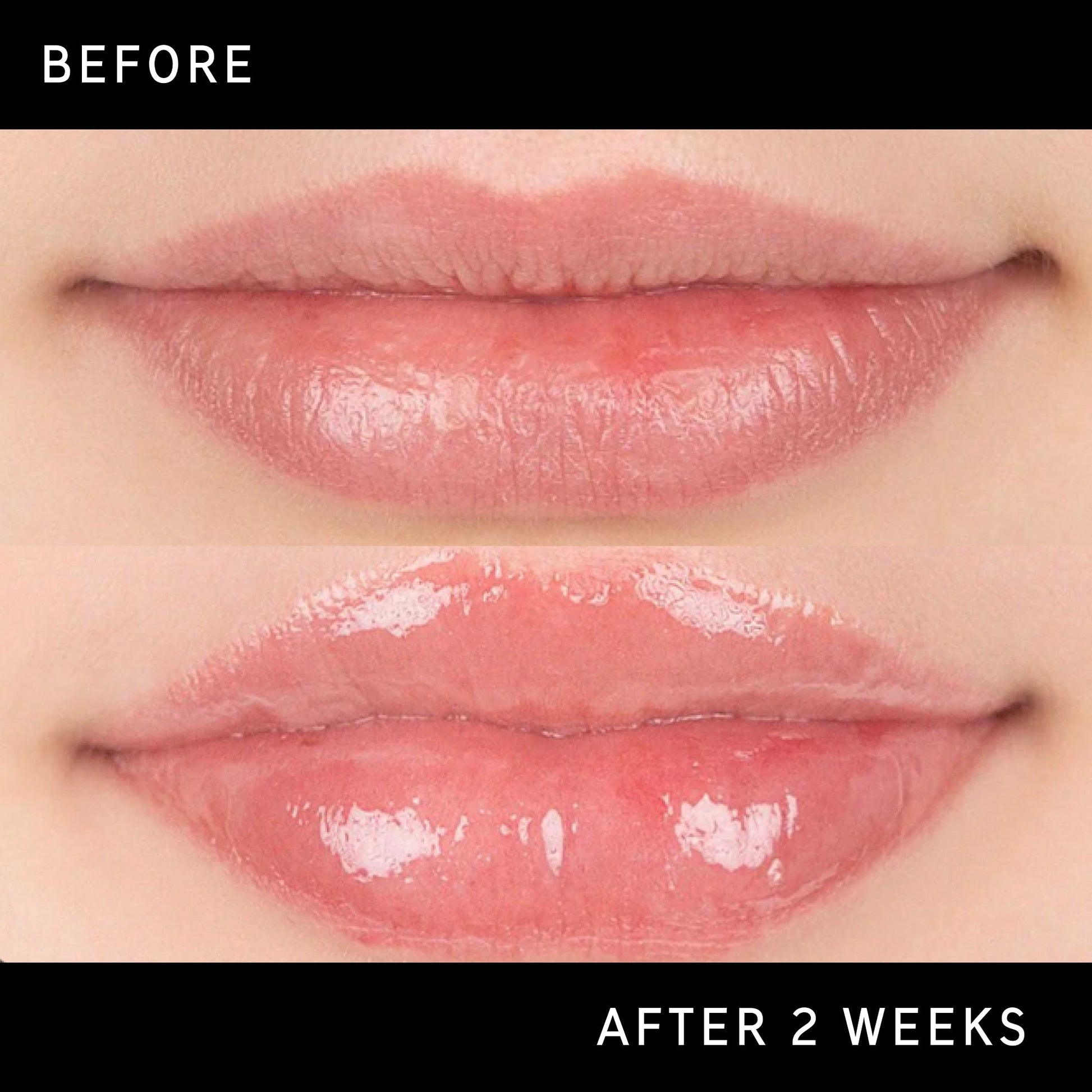 lip-plumping-duo-w1 DTC-Top15_Amends_Tripeptide-Lip_B_A.jpg