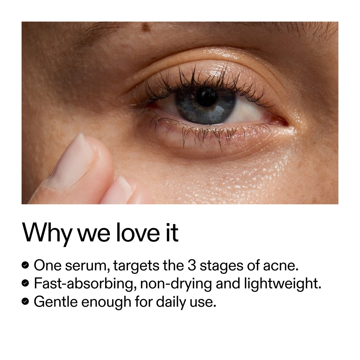 360-acne-clearing-serum-x2 Dioic_Whyweloveit_2000x2000_175aafd3-0cbe-403a-b317-a8362881bfe2.jpg