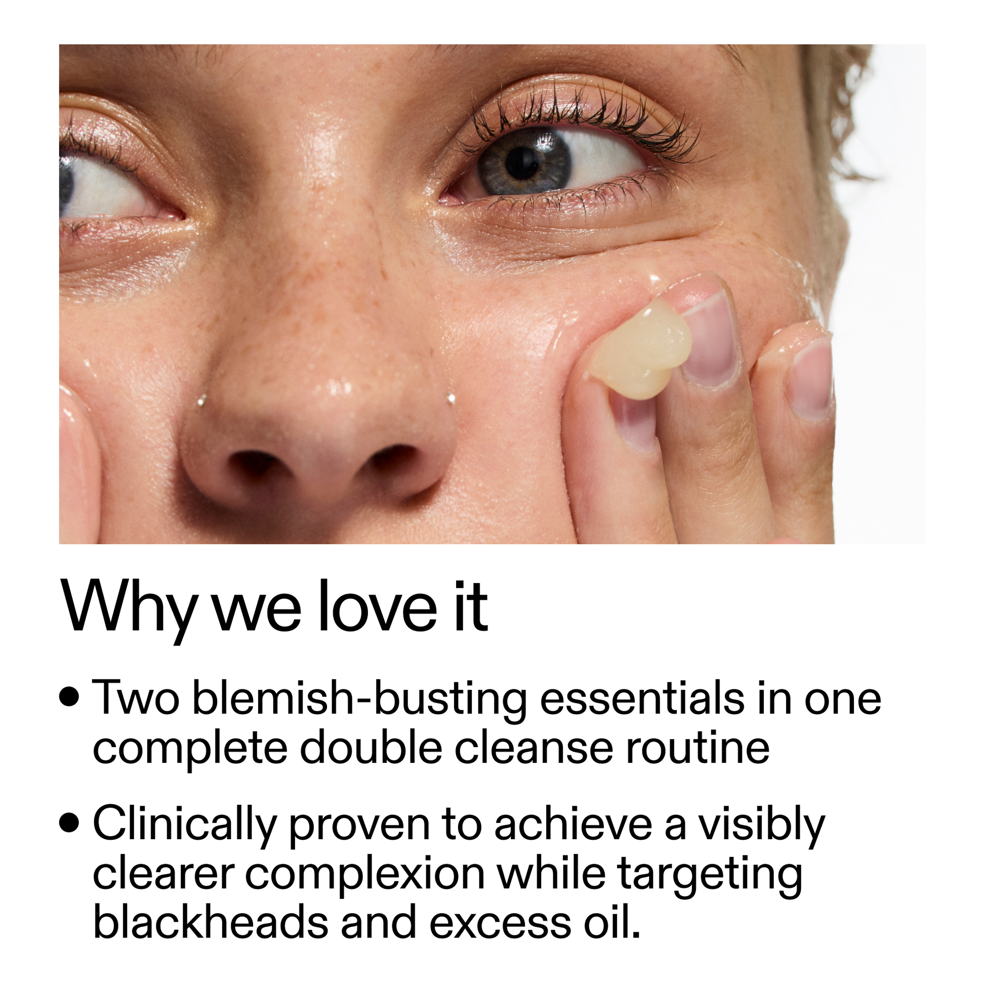 acne-double-cleanse-duo-d9 Double_Cleanse_Duo_for_Breakouts_Why_We_2000x2000_f242cb12-bb5c-487c-b203-071ccb406ec5.png