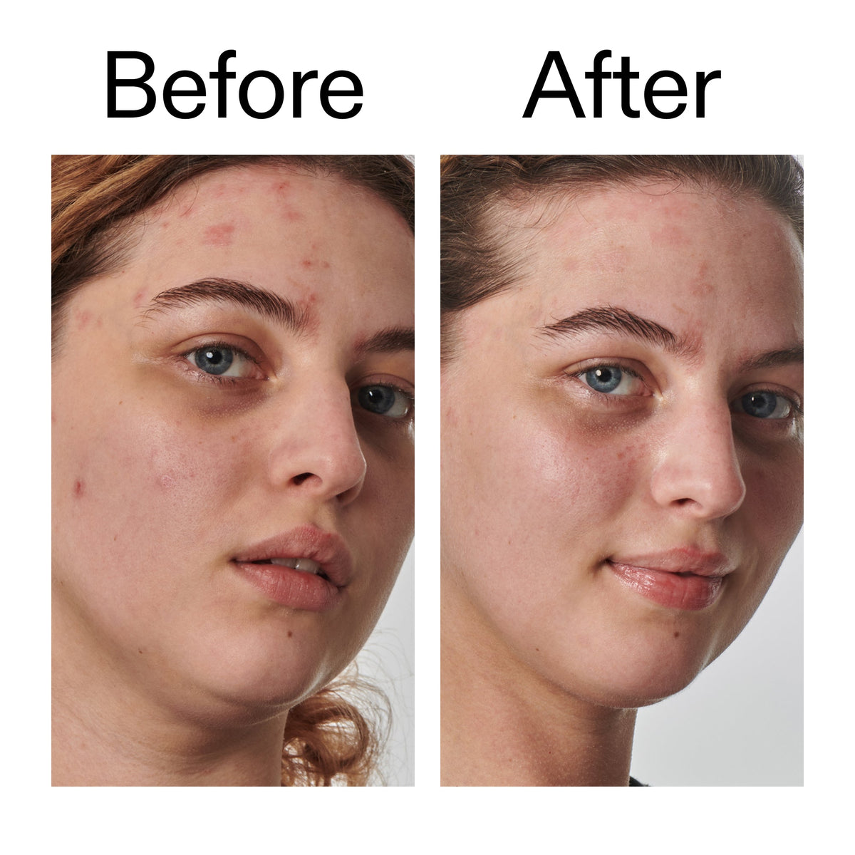 10-urea-moisturizer-p2 Dry_and_Rough_Skin_Solution_Before_After_2000x2000_efa6e639-5c39-49bd-a5dd-f0220293120a.jpg