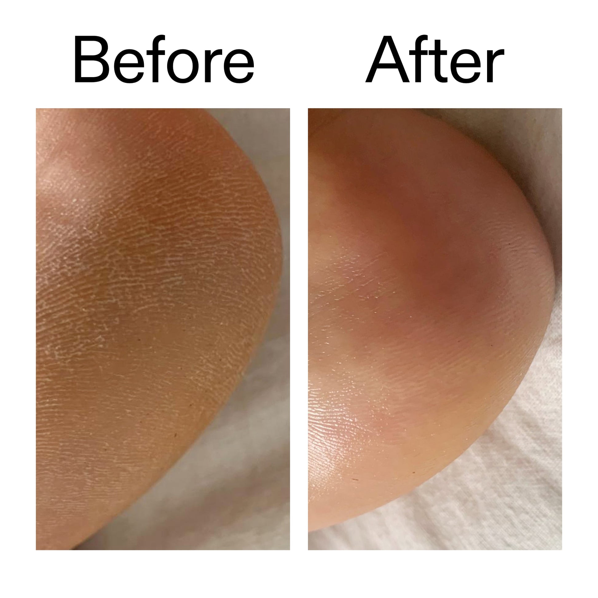 glycolic-acid-exfoliating-body-stick-n1 Glycolic_Acid_Exfoliating_Body_Stick_Before_After_V1_2000x2000_a3043625-9400-429a-a7fb-d6dbd220f722.jpg