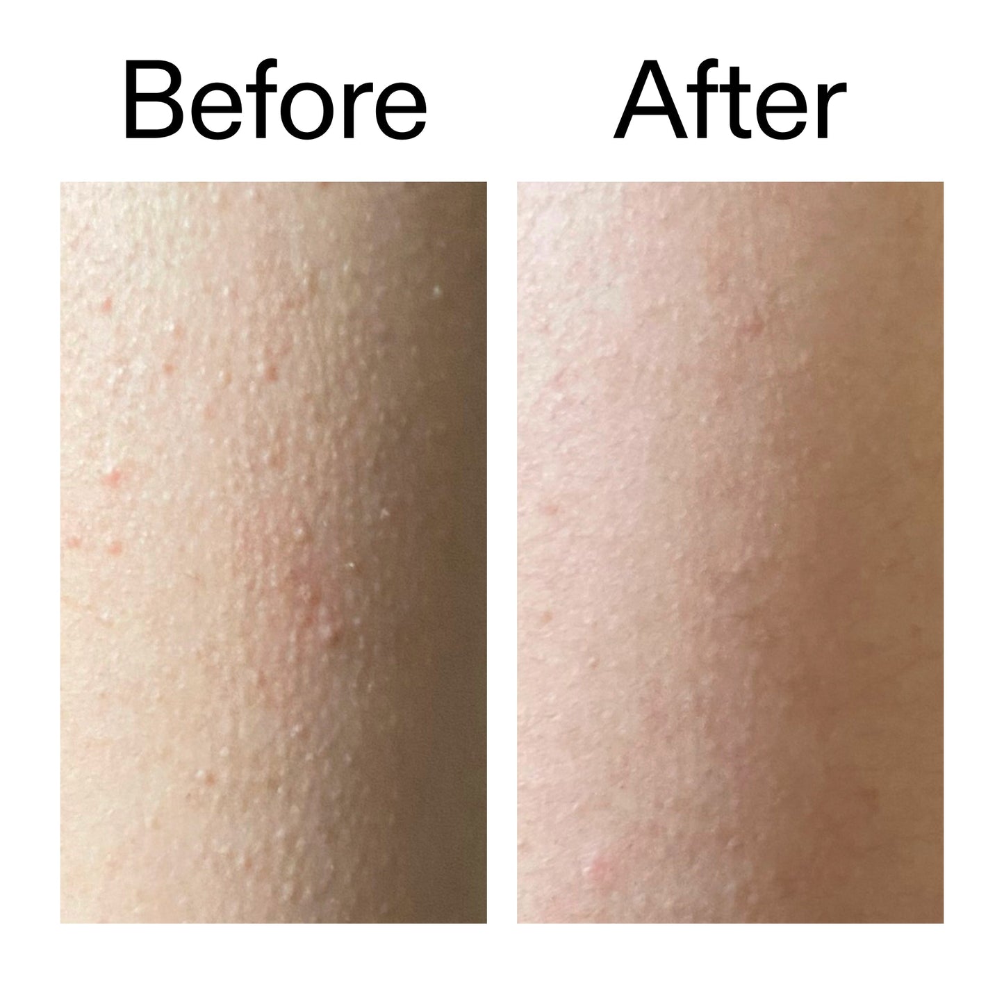 glycolic-acid-exfoliating-body-stick-n1 Glycolic_Acid_Exfoliating_Body_Stick_Before_After_V2_2000x2000_2e4ba052-94f6-4d56-82df-7bdb5b2df7ae.jpg