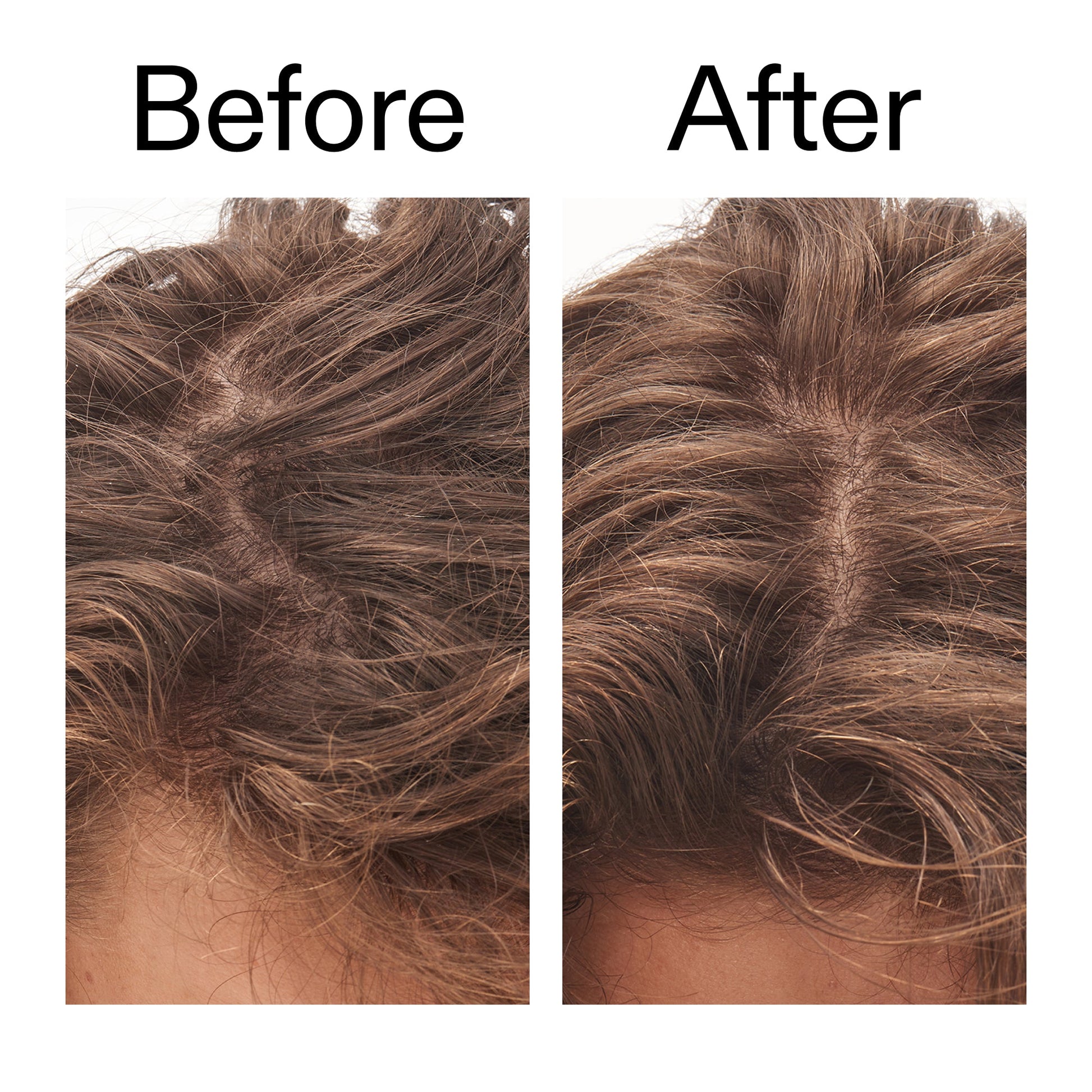 glycolic-acid-exfoliating-scalp-scrub-x2 Glycolic_Acid_Exfoliating_Scalp_Scrub_Before_After_2000x2000_b8561c87-05a1-4caa-80f7-1b6b33d750f7.jpg
