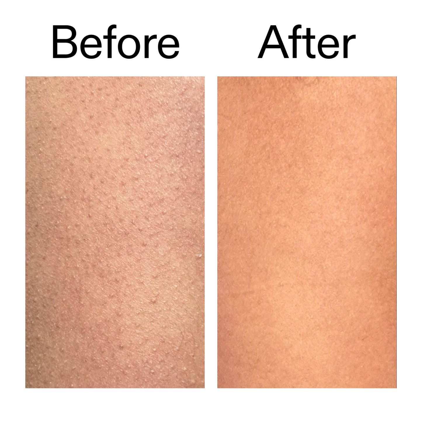 glycolic-acid-exfoliating-body-stick-n1 Glycolic_Body_Stick_B_A_2000x2000_6e6e6b4d-5bd7-43c0-aeed-4d66788e8995.jpg