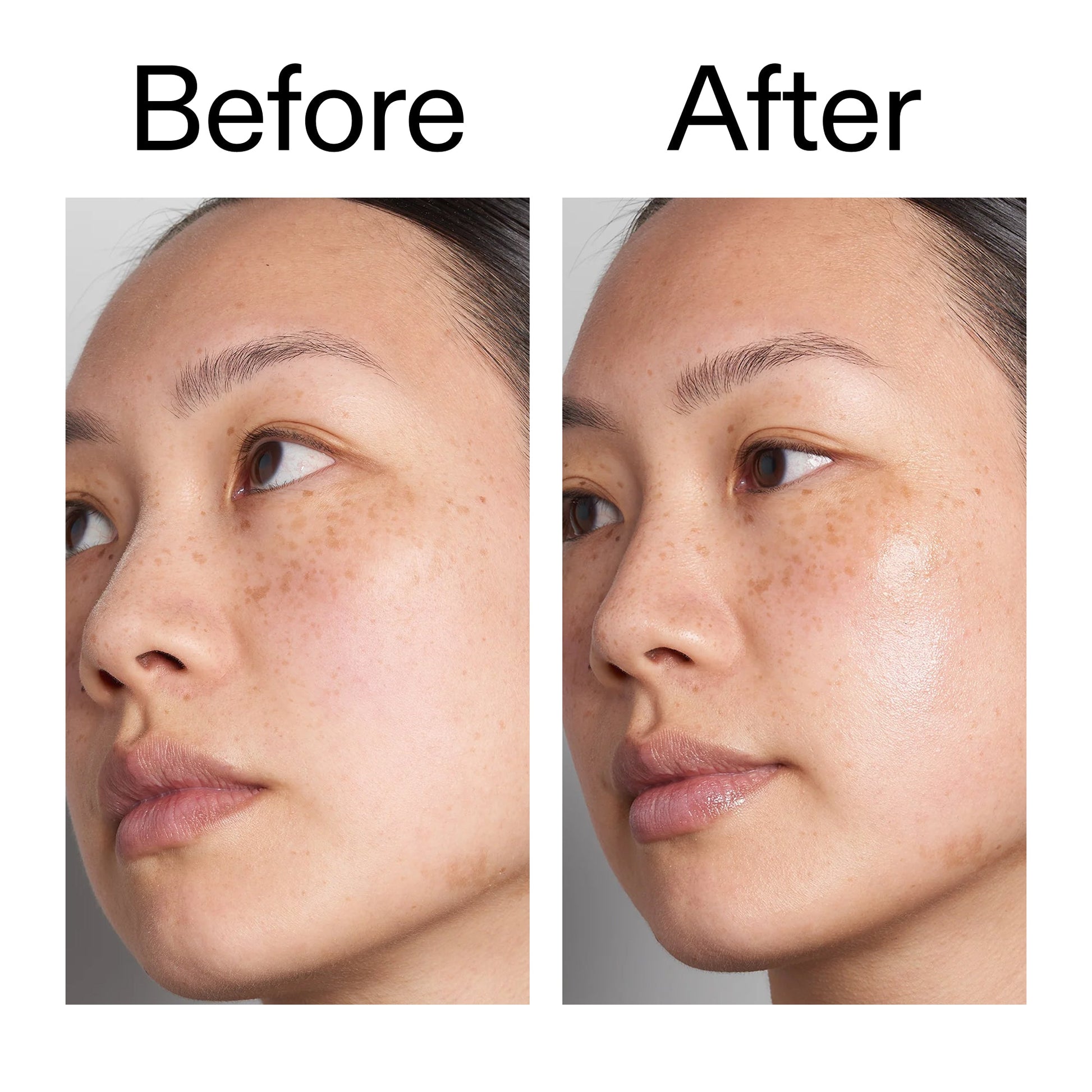 supersize-hyaluronic-acid-serum-100ml-j7 Hyaluronic_Acid_Before_After_2000x2000_d7983956-8aa2-4ea3-8255-c63e8d4f892e.jpg