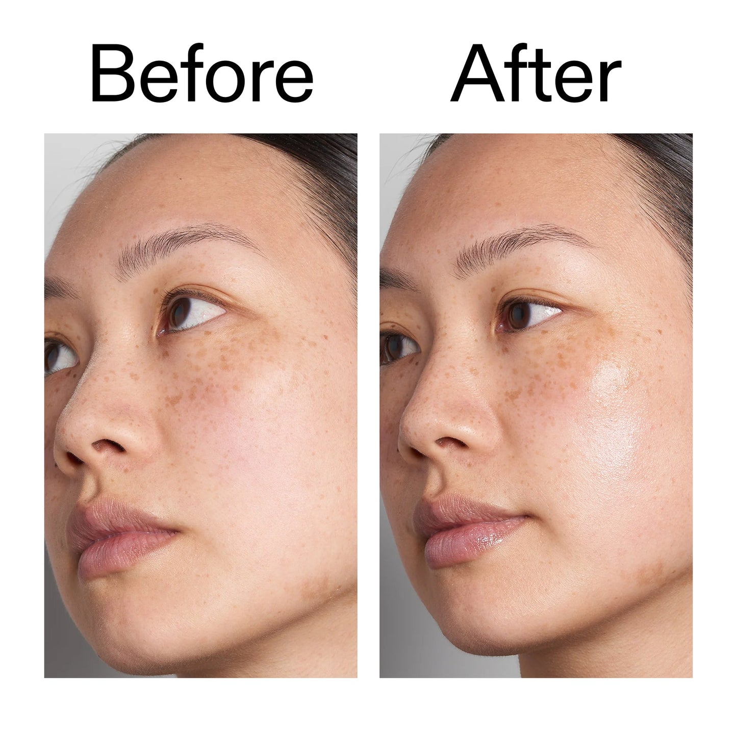 hyaluronic-acid-serum-30ml-o5 Hyaluronic_Acid_Before_After_2000x2000_d7983956-8aa2-4ea3-8255-c63e8d4f892e.jpg