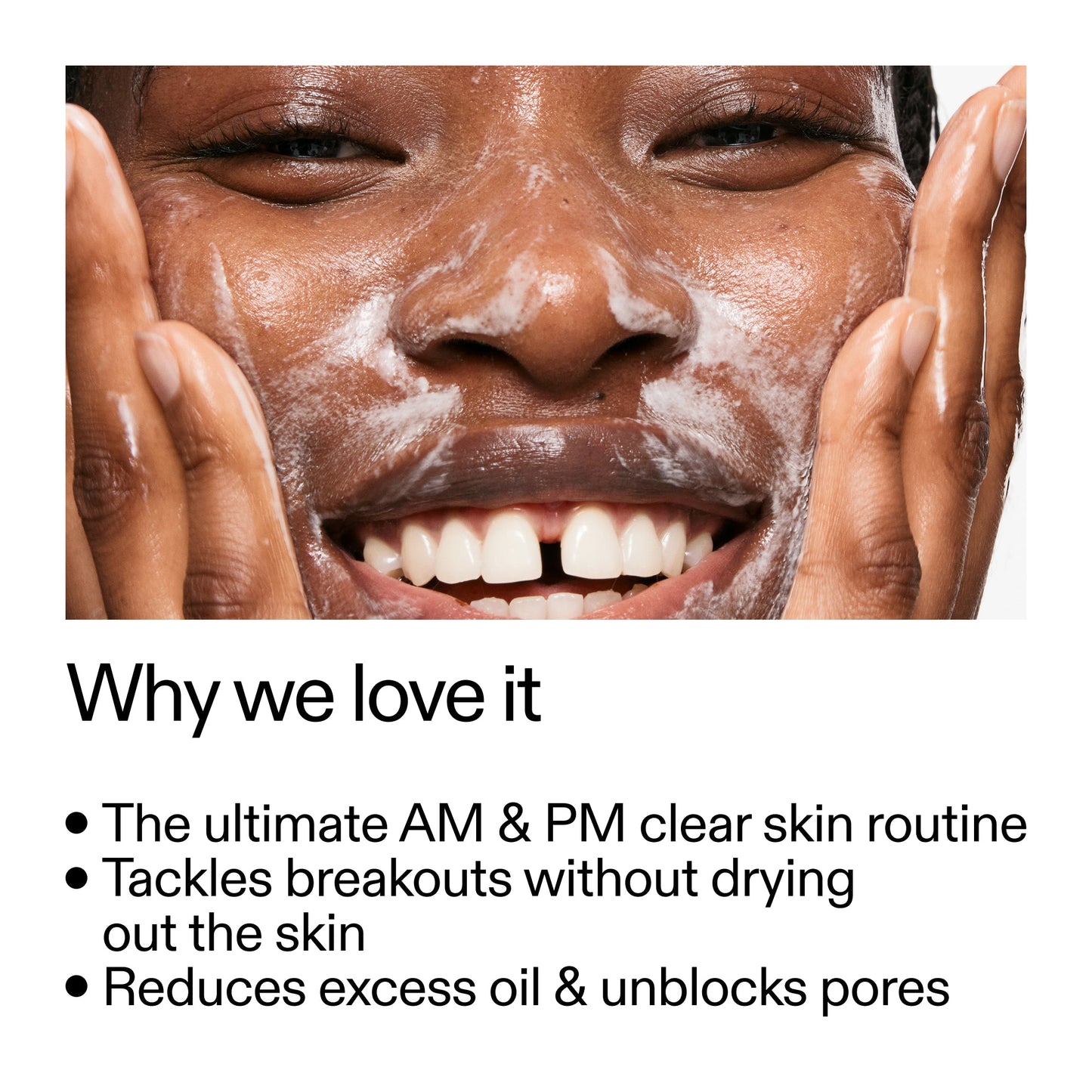 intro-routine-for-acne-x4 Intro_Routine_for_Acne_Why_we_love_it_2000x2000_42499e10-4629-4a0e-a627-7e215f4da6bc.jpg