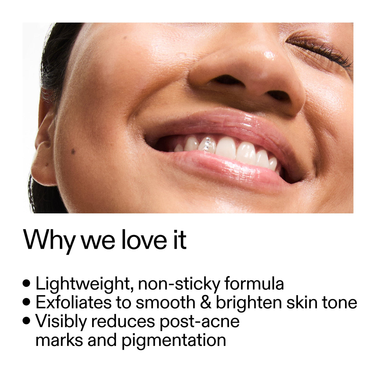 mandelic-acid-treatment-m6 Mandelic_Acid_Treatment_Why_we_love_it_2000x2000_6dfe29a9-2a79-464f-a5e8-e5ac37d93388.jpg
