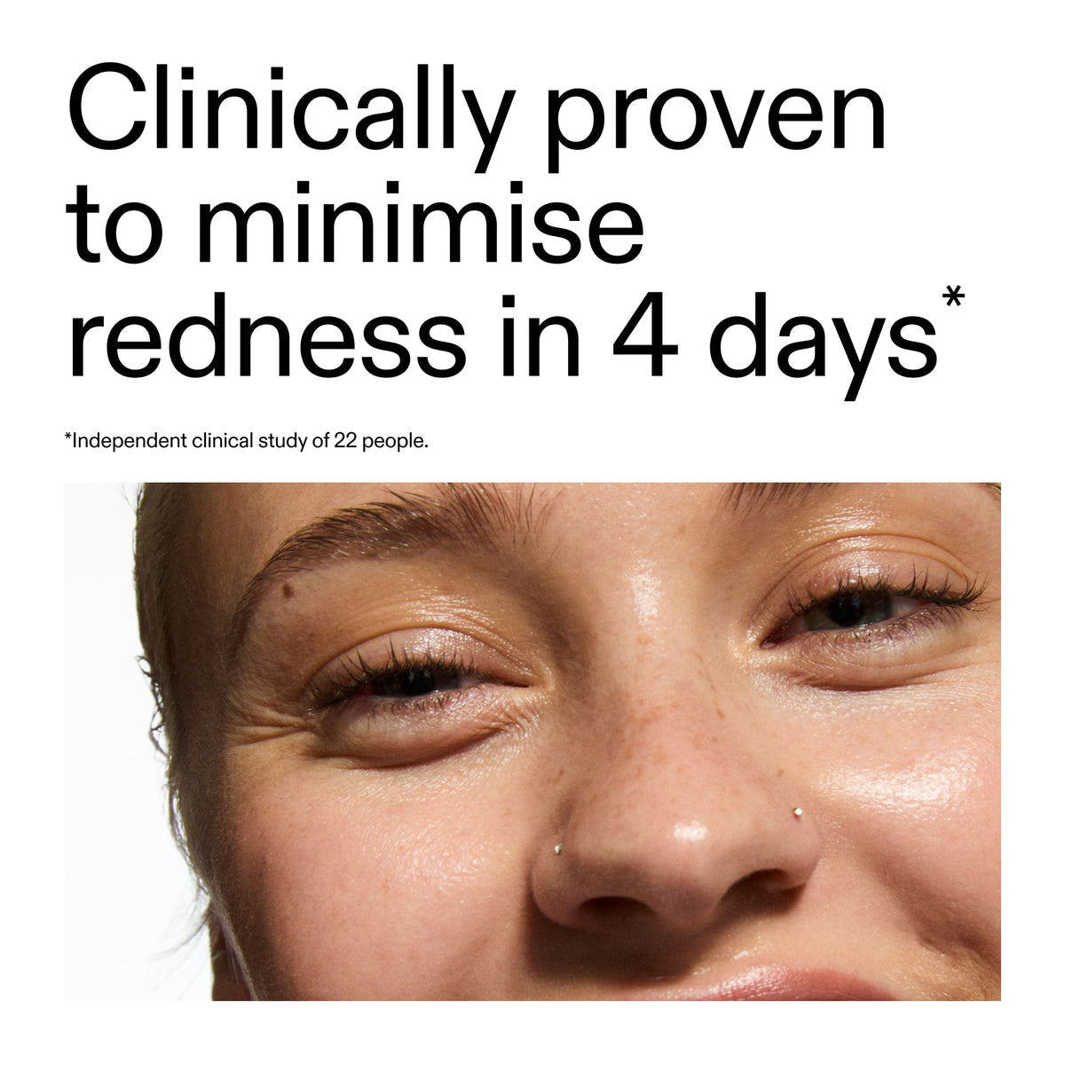10-azelaic-acid-serum-for-redness-relief-u9 Oat_Cleansing_Balm_Claim_2000x2000_52a841dc-353c-4f2c-8646-3aadb604507d.jpg