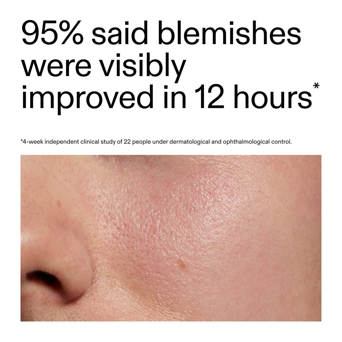 succinic-acid-acne-treatment-b0 Oat_Cleansing_Balm_Claim_2000x2000_ac6ce553-25db-41b2-a981-faae1ac4b8c0.jpg