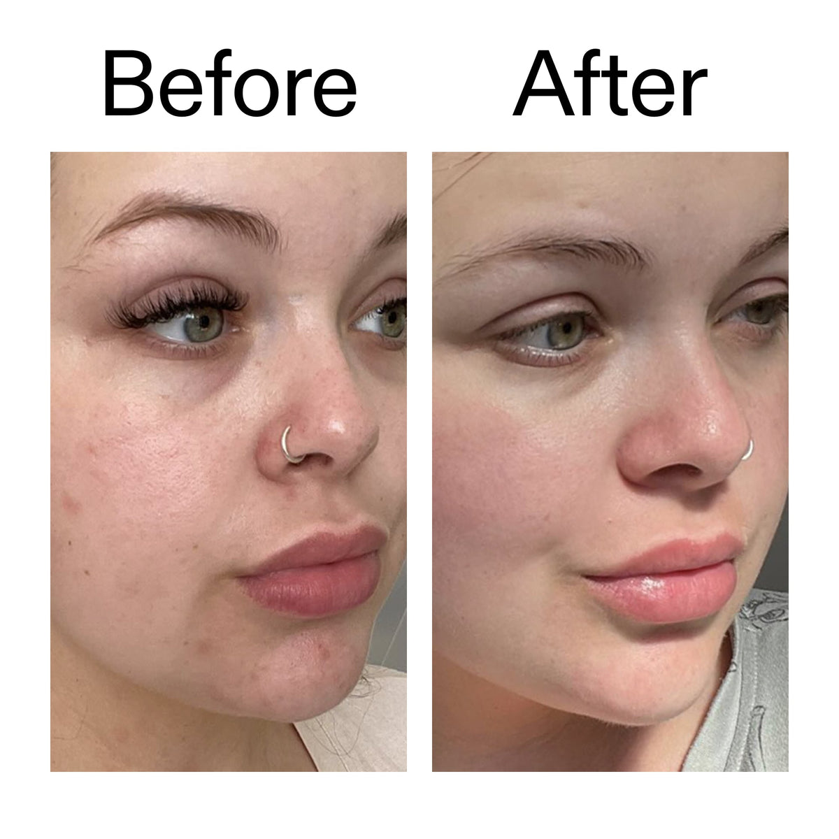 omega-water-cream-50ml-a3 Omega50_Before_After_2000x2000_46483ed8-3f9d-487f-9a0c-9df79830bd65.jpg