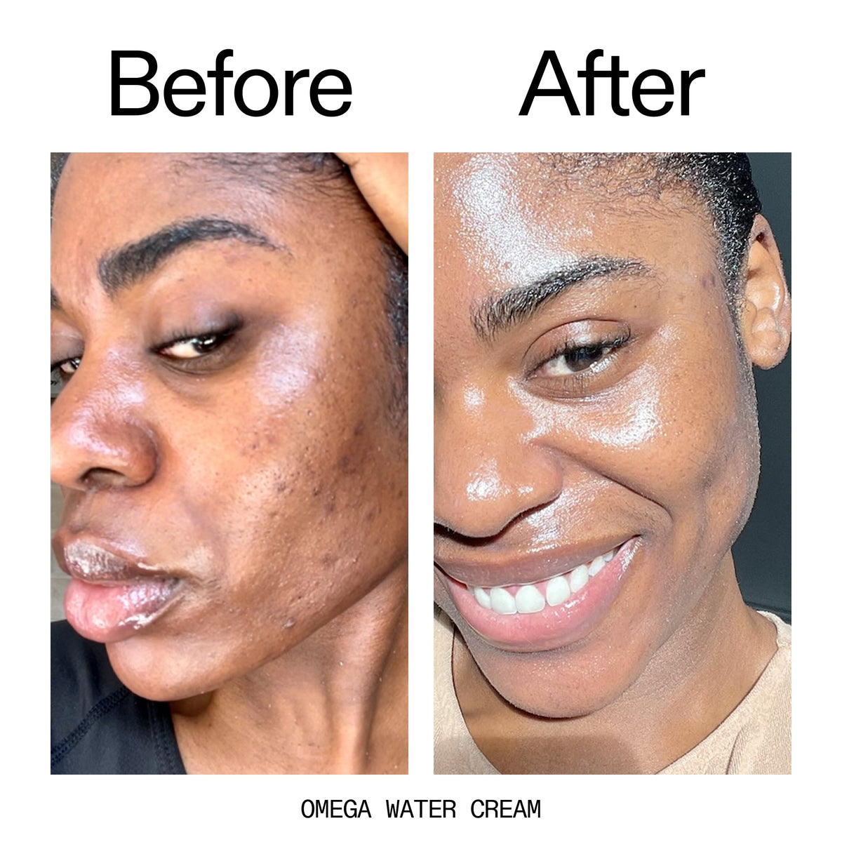 glowing-skin-set-p3 Omega_Water_Cream_Before_After_2000x2000_8e88278b-8c8d-48dc-ac77-4e98ebbd1b77.jpg