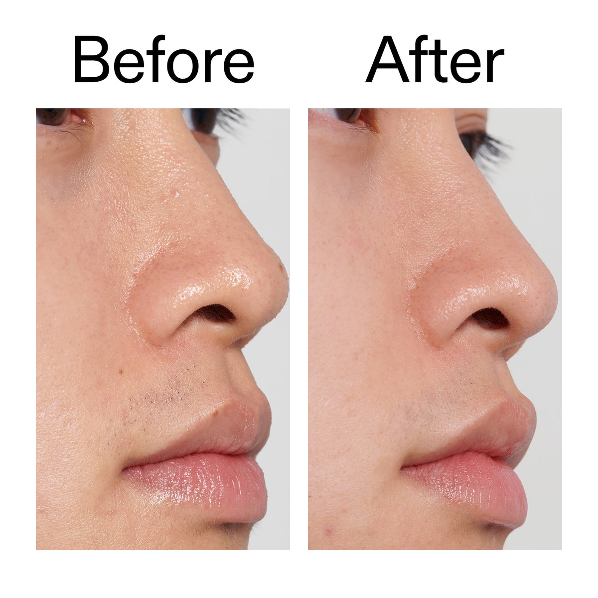 pha-toner-i8 PHA_Toner_Before_After_2000x2000_e3c10172-0150-4342-8b95-57417eaff50d.jpg