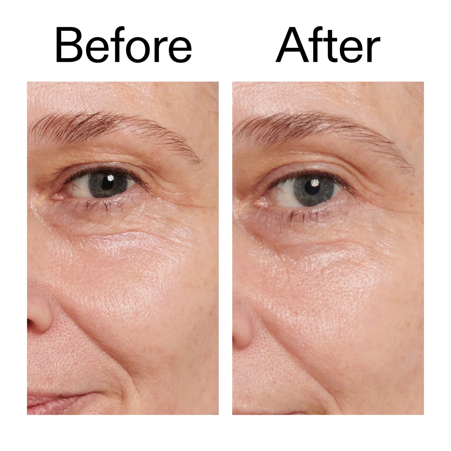 retinol-eye-cream-a2 Retinol_Eye_Cream_Before_After_2000x2000_ac03a80c-109e-4572-a95a-91dc109b4d27.jpg