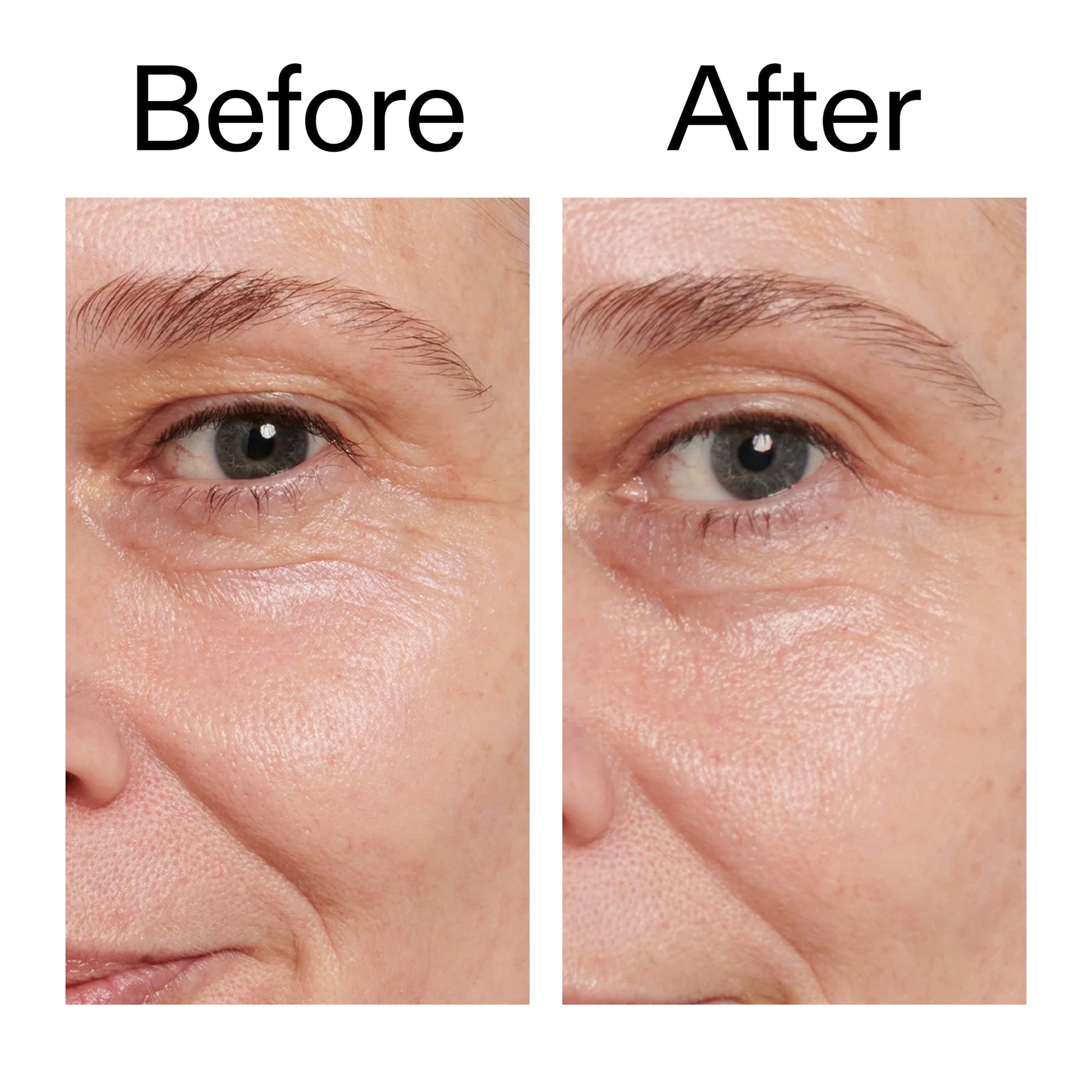 retinol-eye-cream-a2 Retinol_Eye_Cream_Before_After_2000x2000_ac03a80c-109e-4572-a95a-91dc109b4d27.jpg