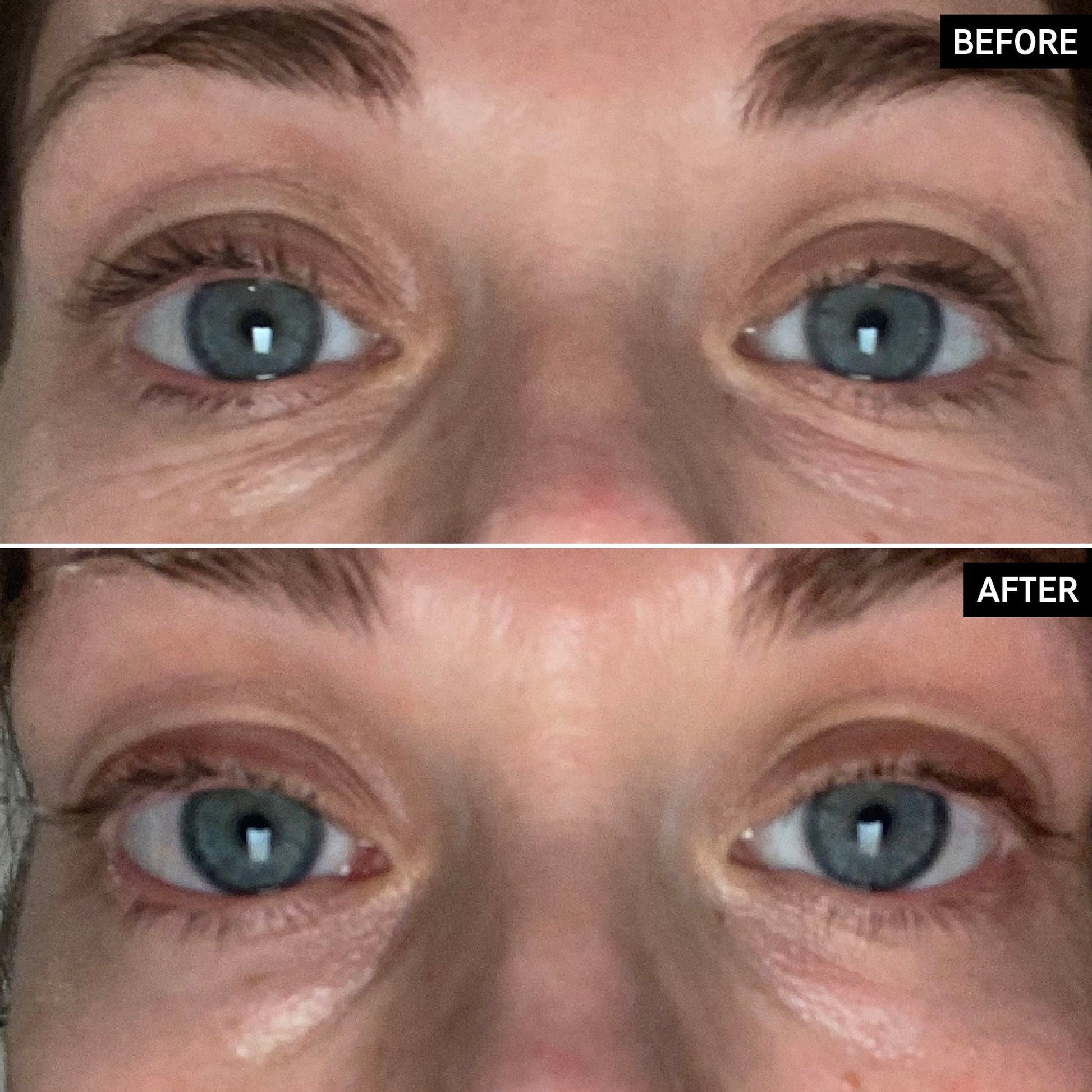 retinol-eye-cream-a2 SITE-UGCBAsApril_Nicole_B_A_PPage_2000x2000_1.jpg