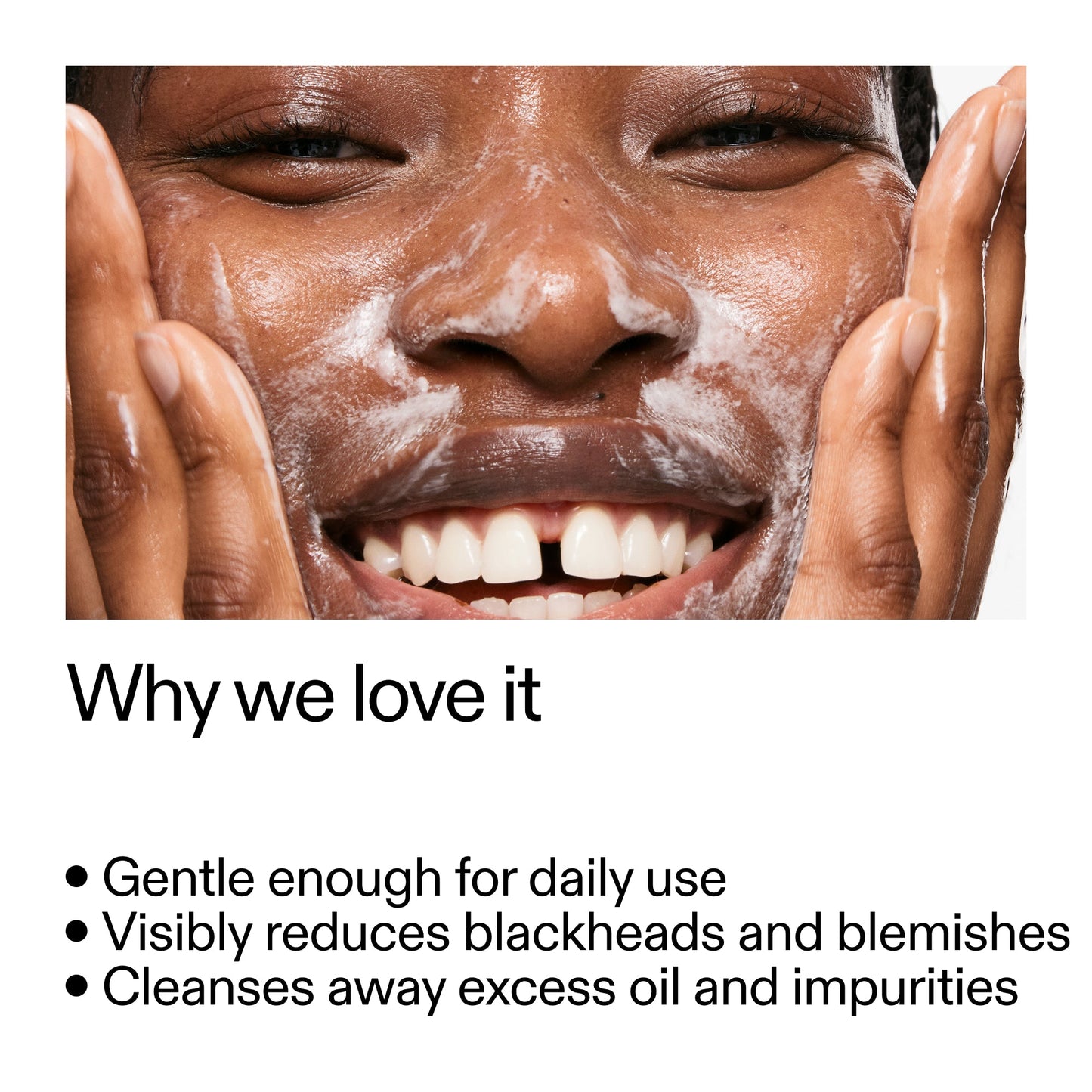 salicylic-acid-cleanser-duo-x0 Salicylic_Acid_Cleanser_-_300mlWhy_we_love_it_2000x2000_87dc92a9-2559-4309-98cd-4e570f1be735.jpg