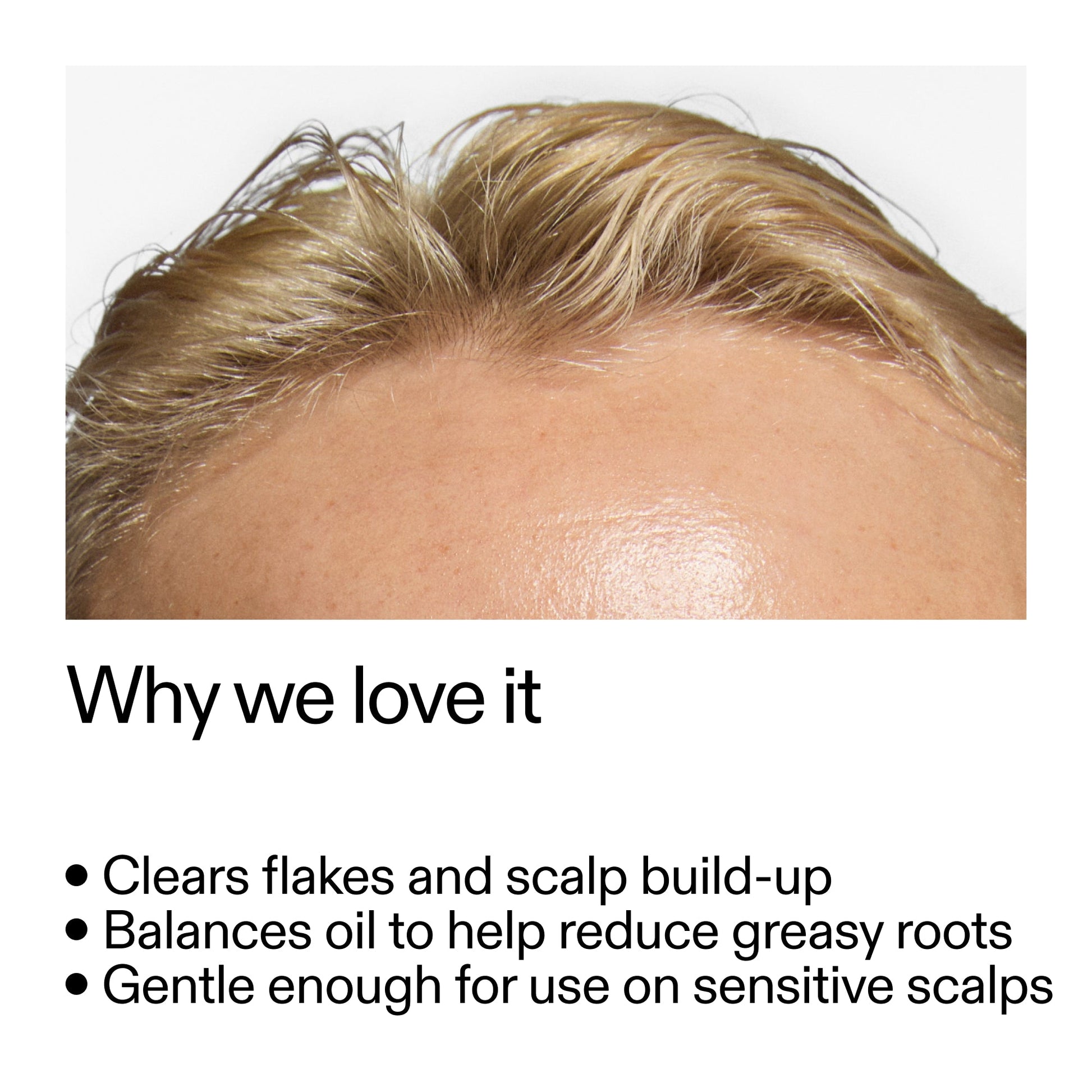 salicylic-acid-exfoliating-scalp-treatment-u1 Salicylic_Acid_Exfoliating_Scalp_Treatment_Why_we_love_it_2000x2000_44b6bd6d-9ec4-4b23-9dc4-bc3fd6f28e14.jpg
