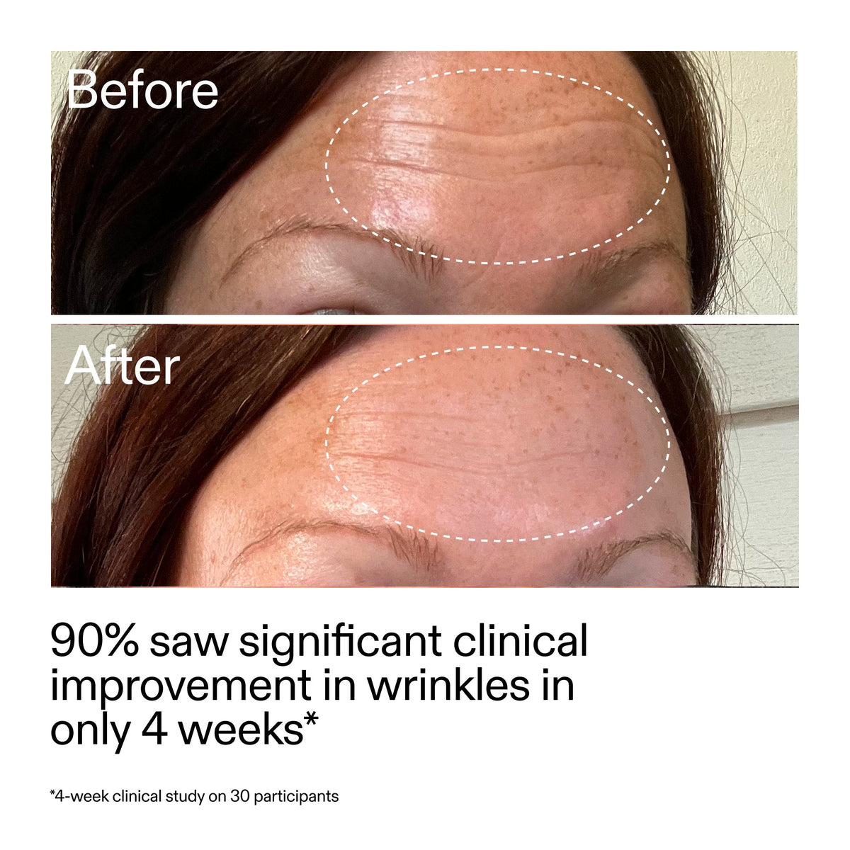 starter-retinol-serum-duo-k9 StarterRetinol_BeforeAfter_Claim1_2000x2000_03b4d6e5-a357-43b9-a855-aba5e35c57f3.jpg