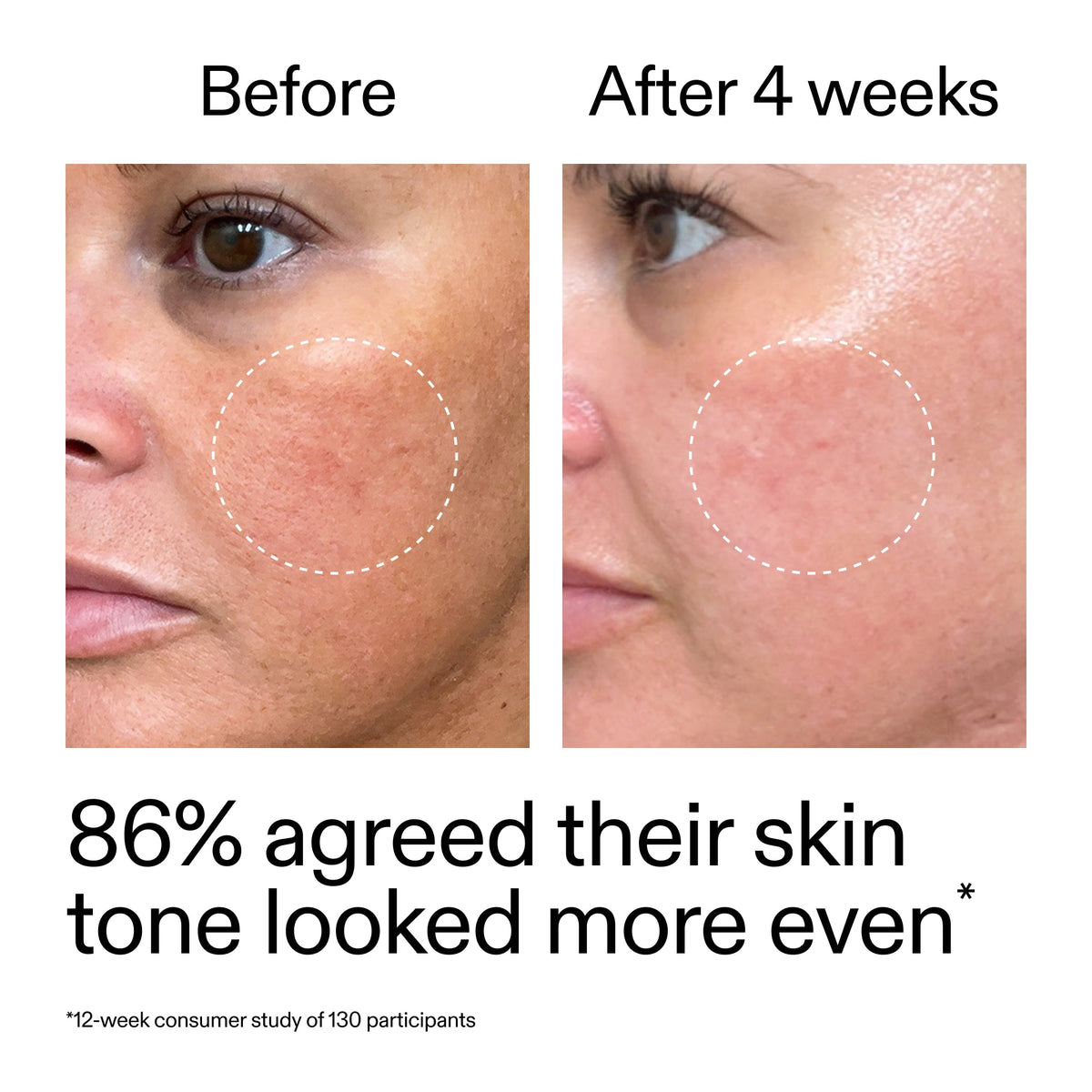 starter-retinol-serum-q2 StarterRetinol_BeforeAfter_Claim2_2000x2000_f5c9ecc0-8d76-429d-bef5-c3a61bcf5c09.jpg