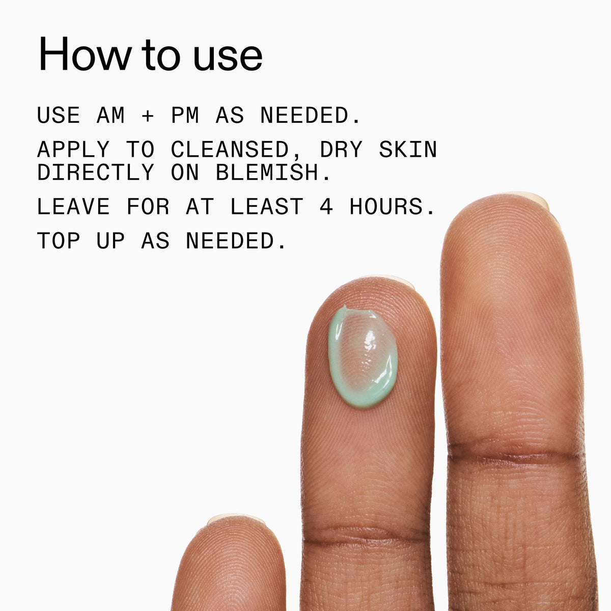 succinic-acid-acne-treatment-b0 Succinic_Acid_Treatment_How_to_Use_2000x2000_d57137d5-d7f1-427c-9a46-5fc00c19c542.jpg