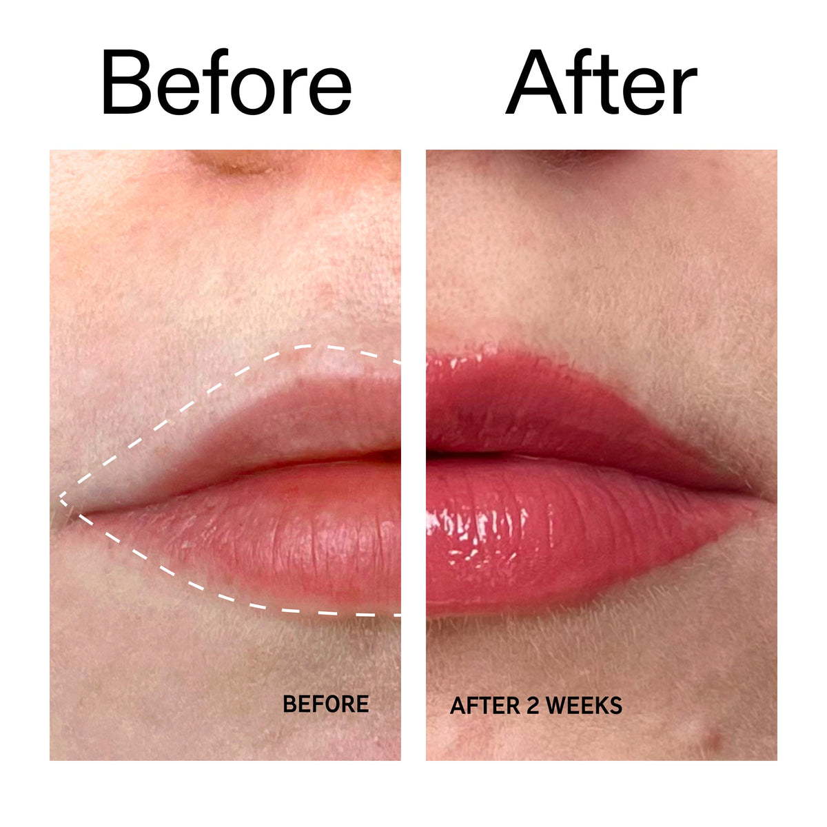 tripeptide-plumping-berry-lip-balm-d1 Tripeptide_Plumping_Lip_Balm_-_Berry_Before_After_2000x2000_9474bbd8-43ca-4b0e-b0e7-dfab70b91927.jpg