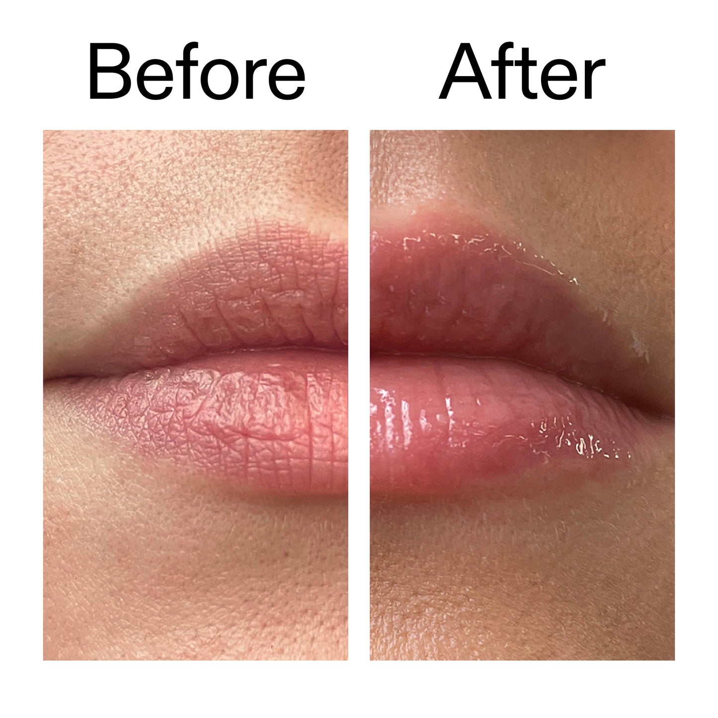 tripeptide-plumping-lip-balm-c6 Tripeptide_Plumping_Lip_Balm_Before_After_2000x2000_b4a5ee04-d2ac-4857-8f01-17209acc4bf3.jpg