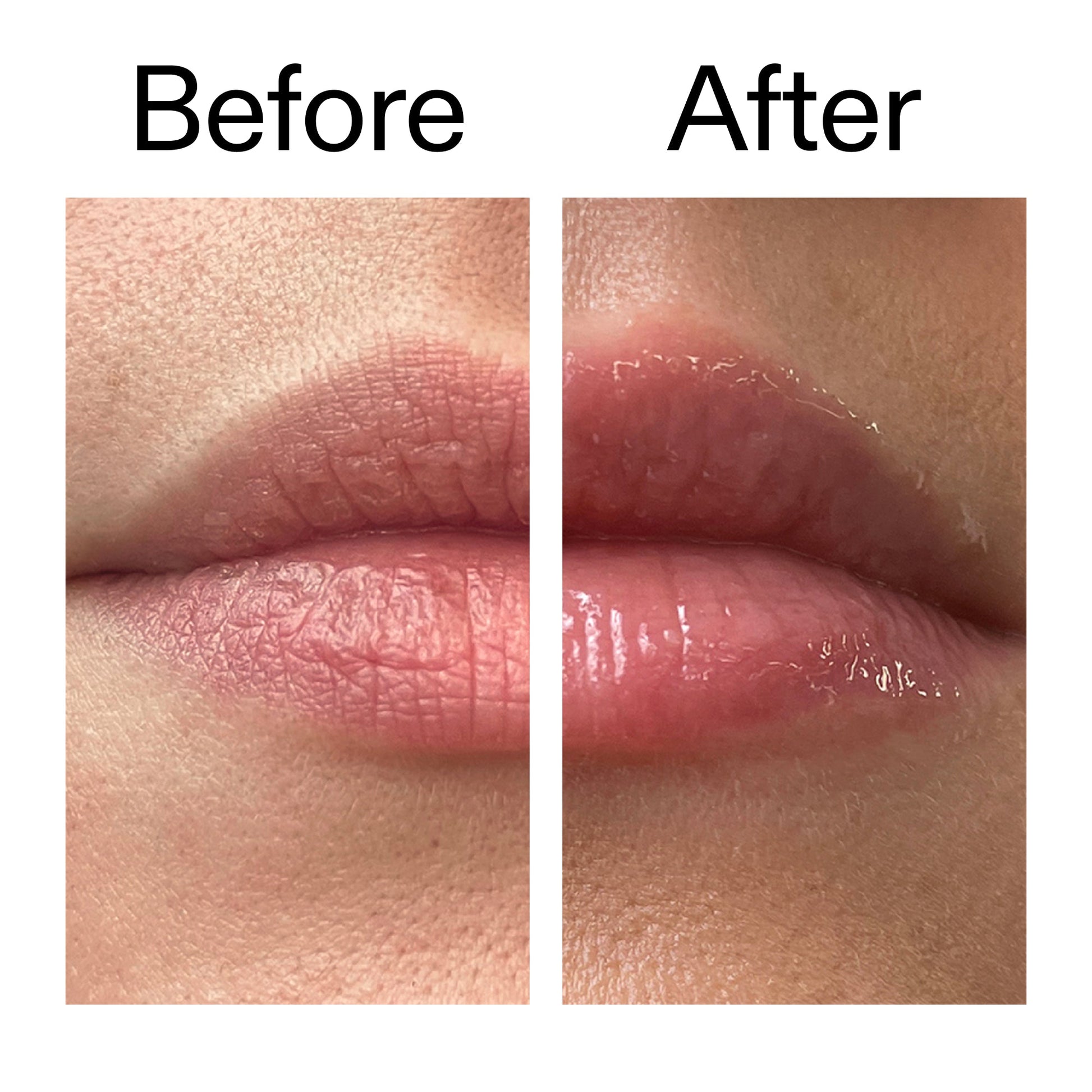 tripeptide-plumping-lip-balm-c6 Tripeptide_Plumping_Lip_Balm_Before_After_2000x2000_b4a5ee04-d2ac-4857-8f01-17209acc4bf3.jpg