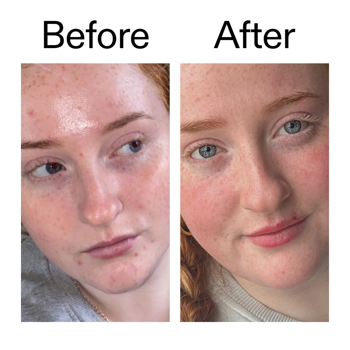 vitamin-b-c-and-e-moisturizer-x2 Vitamin_B_C_and_E_Moisturizer_Before_After_2000x2000_b0781a76-5ad2-4be9-95b8-ef92b356833c.jpg